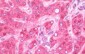 GBP5 Antibody